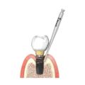 T-Brush