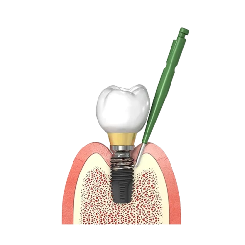 I-Brush2