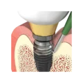 I-Brush2