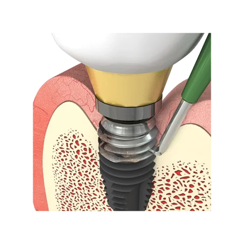 I-Brush2