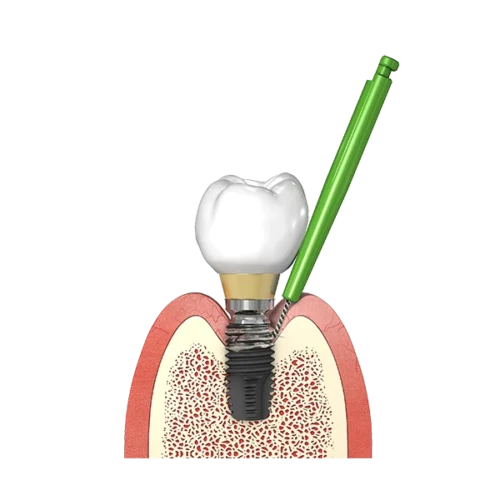 I-Brush1