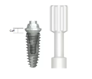 Abutment slika