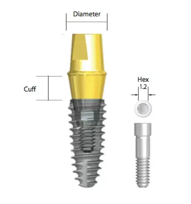 Abutment slika