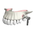 Sinus All Kit