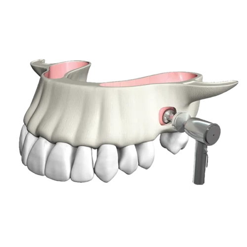 Sinus All Kit