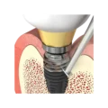 T-Brush
