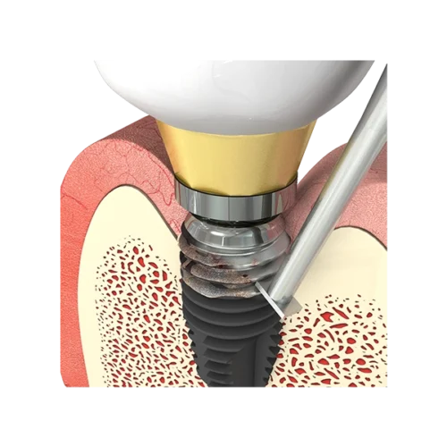 T-Brush