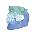RAY 5D Solution
