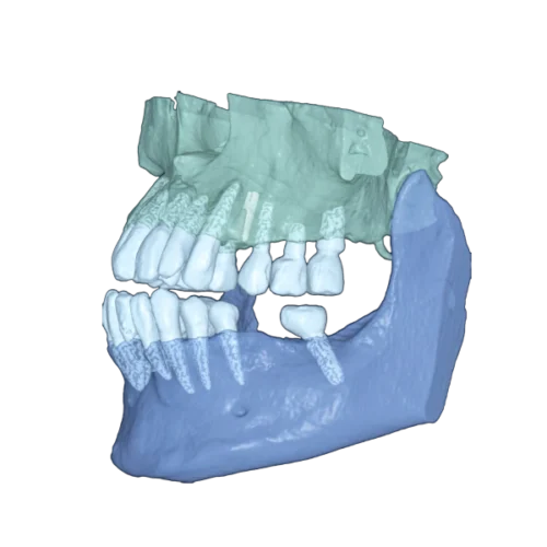 RAY 5D Solution