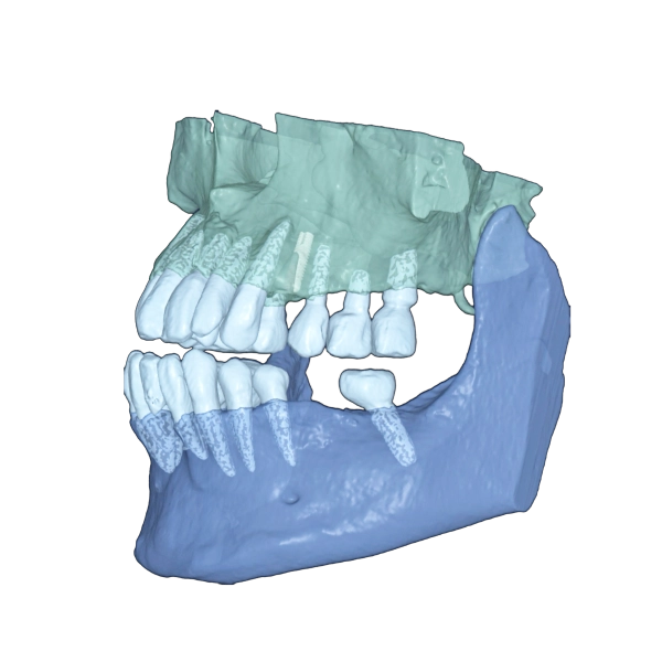 RAY 5D Solution