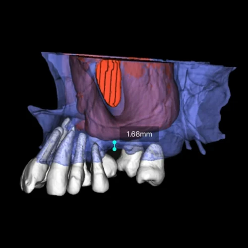 RAY 5D Solution