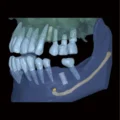 RAY 5D Solution