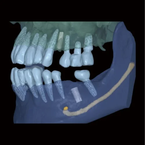 RAY 5D Solution