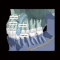 RAY 5D Solution