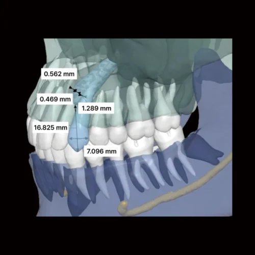 RAY 5D Solution